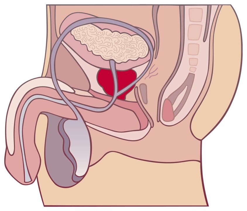 Tout sur la prostatite