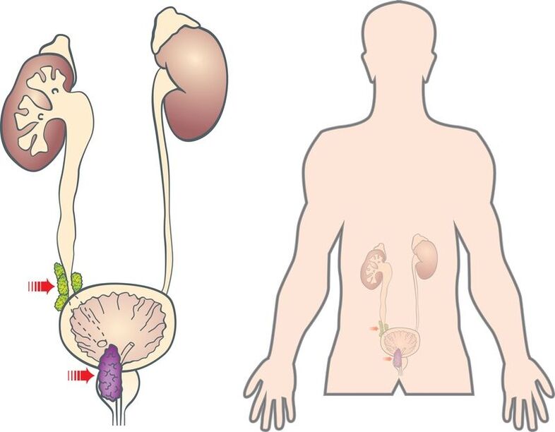 Symptômes et causes de l'adénome de la prostate