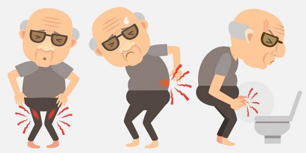 Symptômes de la prostatite